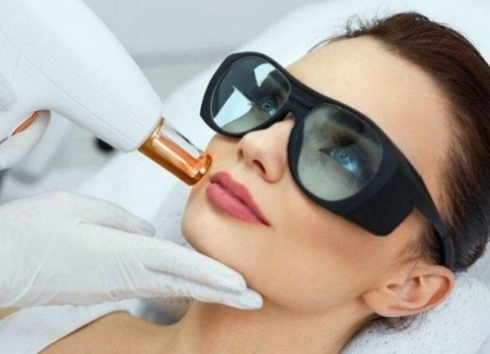 Naha naha näo noorendamine