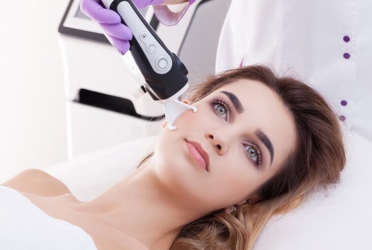 Laser noorendamine