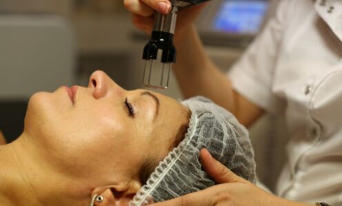 fraktsionaalne termolüüs noorendamiseks